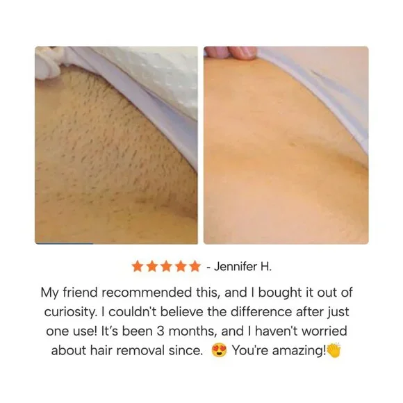 EPIFY - Picture 12 of 15